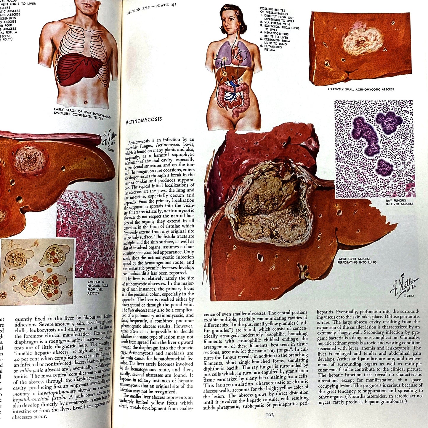 The Ciba Collection of Medical Illustrations Vol. 3 Digestive System By Frank H. Netter. M.D 1953 Hard Back Book